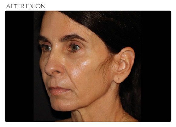 Exion in Fairfax
