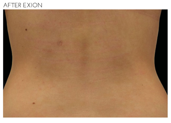 Exion in Fairfax