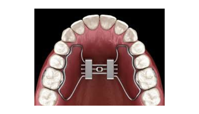 Orthodontics in Fairfax