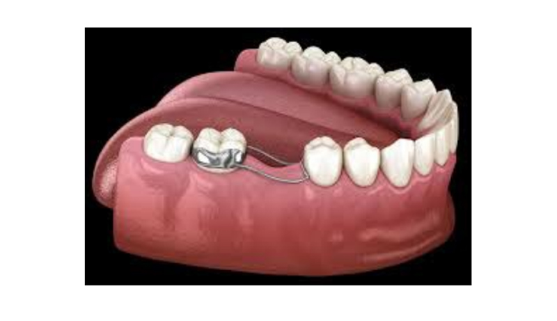 Orthodontics in Fairfax